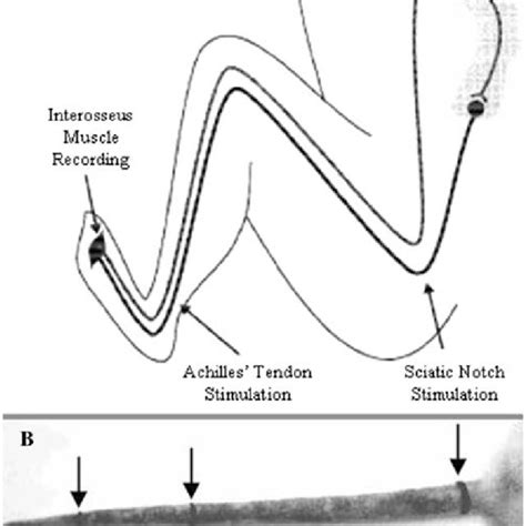 A Schematic Diagram Showing Positions Of Recording And Stimulating Download Scientific Diagram