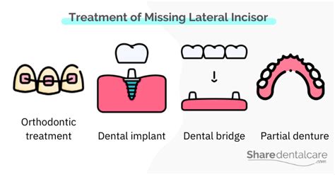 Missing Baby Teeth Lateral Incisor Share Dental Care