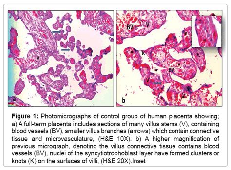 Placenta Histology Labeled