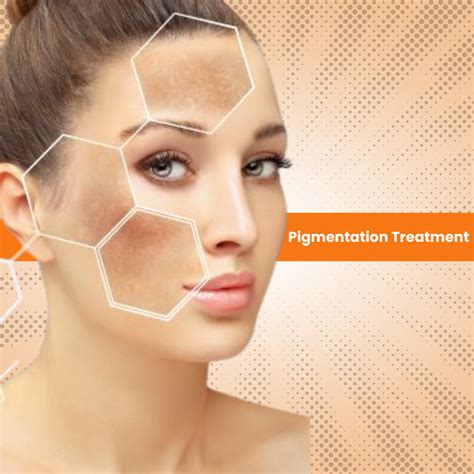 The Ultimate Guide To A Pigmentation Treatment Kit Crivva