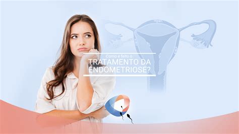 Como é feito o tratamento da endometriose Dr Augusto Bussab