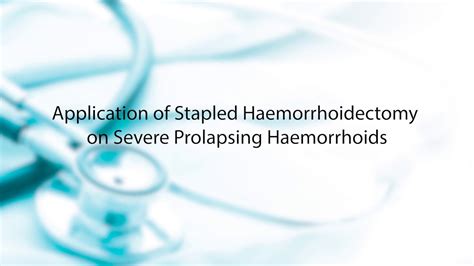 Stapled Haemorrhoidectomy On Severe Prolapsing Haemorrhoids Youtube