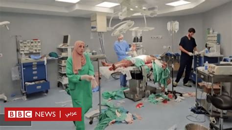 حرب غزة عمليات جراحية في أروقة المستشفى الإندونيسي شمال قطاع غزة