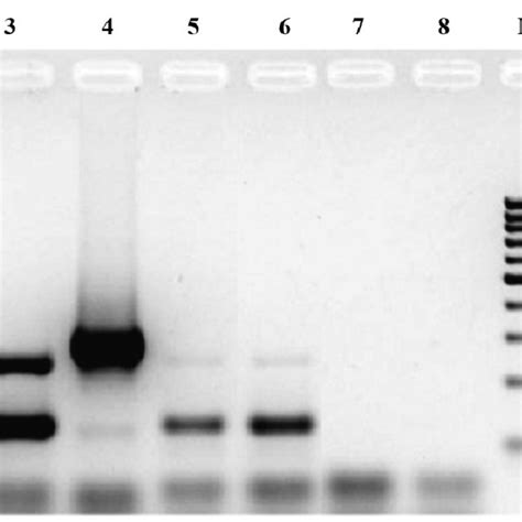 Agarose Gel Electrophoresis Of Mitochondrial Multiplex Pcr Products