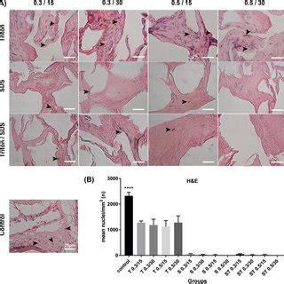 A Histological Analysis Of Decellularized Placenta Fragments In Fresh