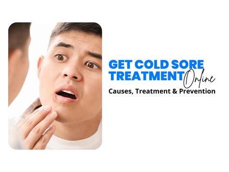 Conveniently Addressing Cold Sores Online: Causes, Treatment, and Prevention with AlphaCare Inc.