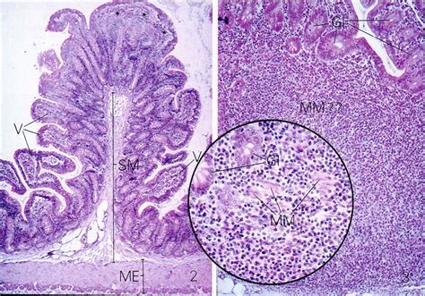 Digestive System Part 7 The Ileum Tissue Biology Digestive System