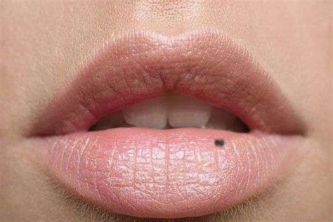 What Is The Meaning Of Mole On Lower Lips