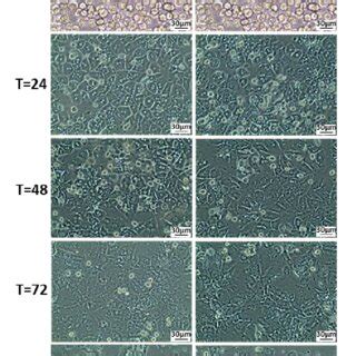 Morphology Of Wild Type WT And Mucopolysaccharidosis I MPS I Murine