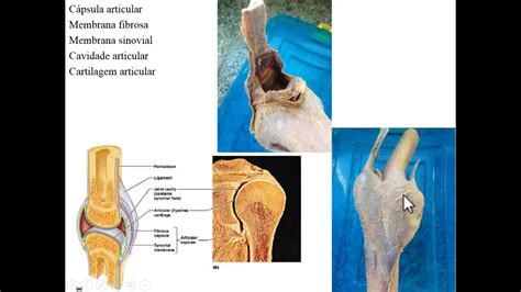 Articulações Interapofisárias O Que é