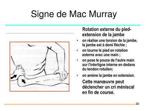 PPT Pathologie péri articulaire membre inférieur PowerPoint