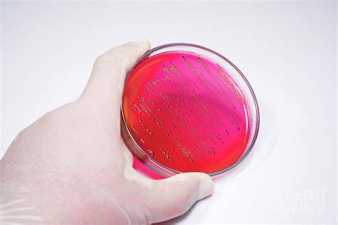 Escherichia Coli Bacteria On Blood Agar Photograph By Choksawatdikorn