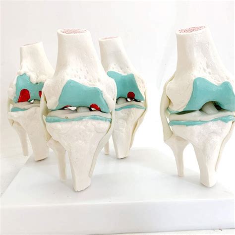 Buy Human Anatomical Model Knee Joint Modelhuman Lesion Knee Anatomy