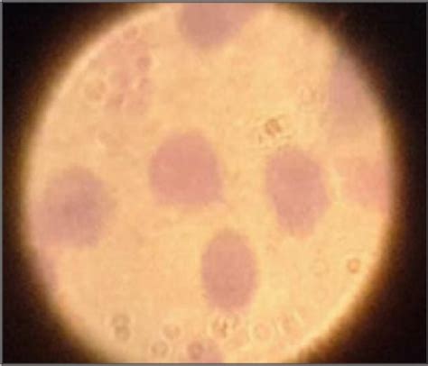 Trophozoites Of Giardia Duodenalis Stained With Giemsa 100x Download Scientific Diagram