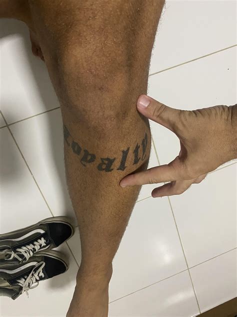 Acute left knee pain - help : r/Kneesovertoes