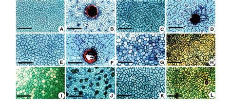 Characteristics Of Epidermal Cells Adaxial Epidermis On The Left