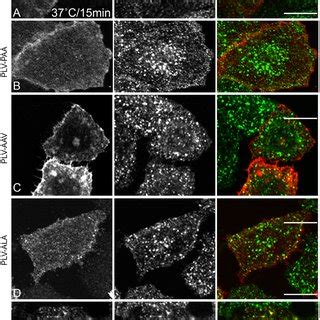 Delineation Of Endocytic Sorting Motif In Kremen Hela Cells Were