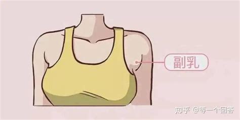 胸部下垂外扩有副乳怎么办如何拥有完美胸部 知乎