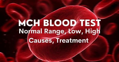 MCH Blood Test: High, Low, Symptoms, Treatments, Complete Details ...