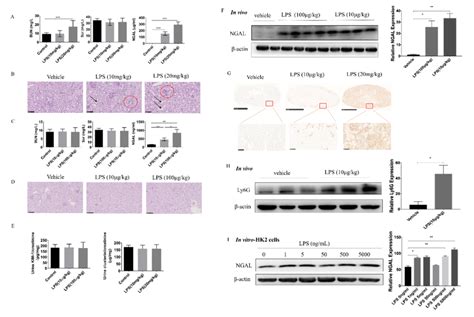 Serum Ngal Is A Sensitive And Accurate Biomarker To Assess