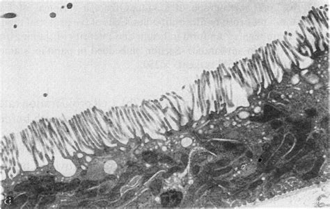A Electron Micrograph Showing Proximal Tubule Microvilli In A