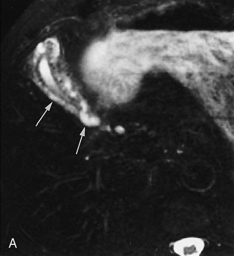 imaging   gallbladder magnetic resonance imaging clinics