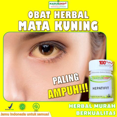 Jual Obat Mata Kuning Kering Dan Merah Liver Hepatitis Ampuh Special