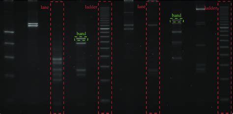 HPV Typing Via PCR RFLP Gel Electrophoresis A The Steps Involved In