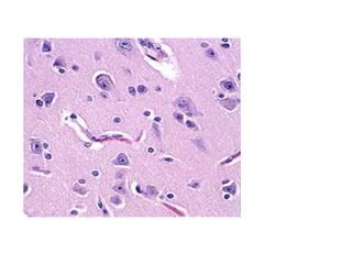 Histology of cerebellum and cerebrum