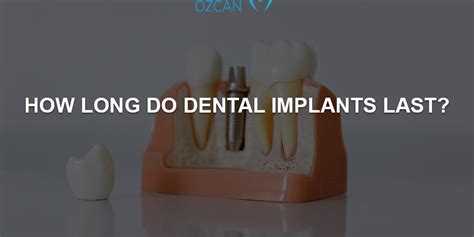 How Long Do Dental Implants Last Prof Dr Özlem Özcan