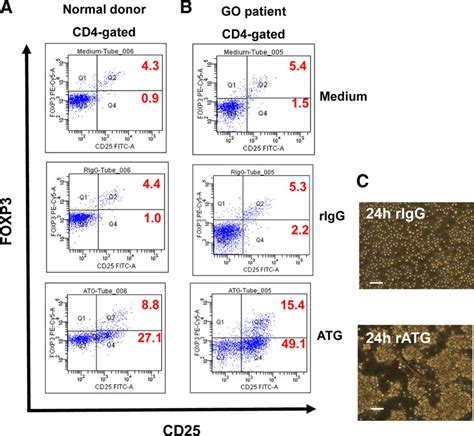 Expression Of CD4 CD25 FoxP3 Treg Cell Markers On PBMCs Of A GO