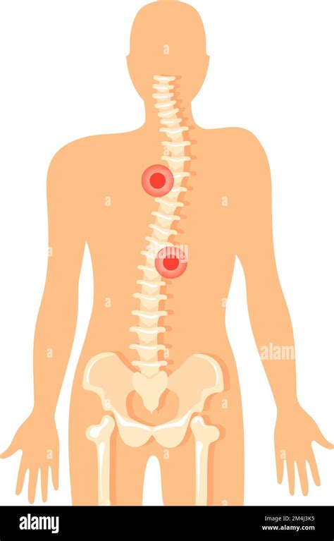 Backbone Pain Spine Ache Icon Vertebral Column Diagram Isolated On