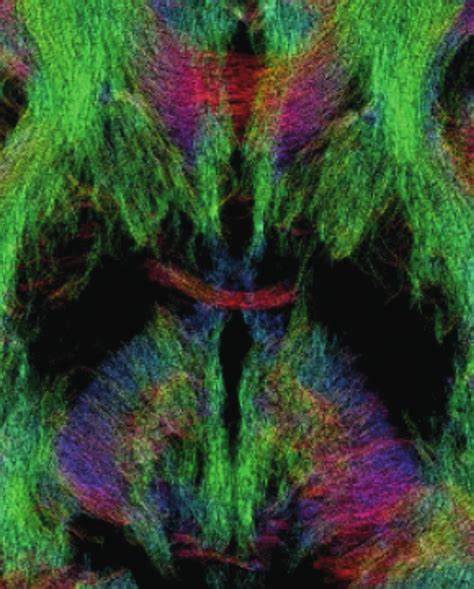 A Diffusion Tensor Imaging At 0 8 Mm Isotropic Resolution On The