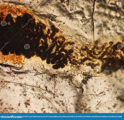 Pinworms Eggs Enterobius Vermicularis In Stool Examination Under