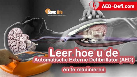 Leer Hoe U Een Automatische Externe Defibrillator AED Te Gebruikenen