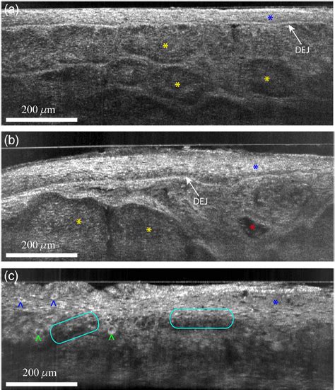 Line Field Confocal Optical Coherence Tomography For High Resolution