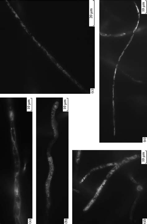 Micromorphology Of P Anserina Gfp1 Strain With Fluorescent Download Scientific Diagram