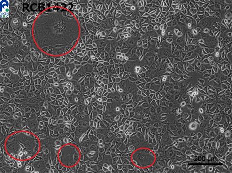 L929 cell morphology좀 봐주세요 BRIC