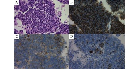 Pathological Findings Of The Computed Tomography Guided Percutaneous