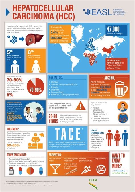 Hepatocellular Carcinoma Infographic