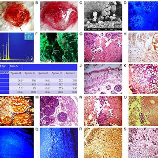 Ehrlich Subcutaneous Tumor Model Before And After The Treatment With