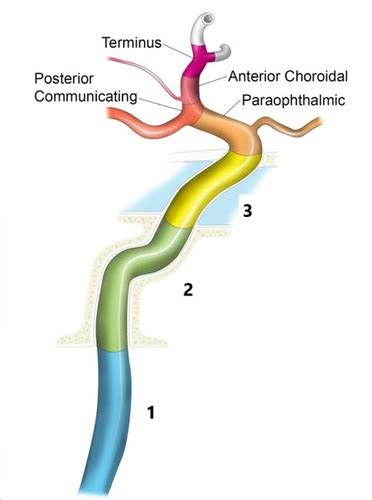 Chapter 18 Cerebrovascular Anatomy Flashcards Quizlet