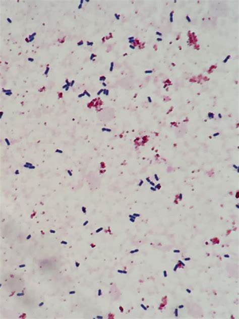 Listeria Gram Stain