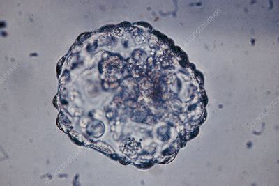 Lm Of Blastocyst Six Day Embryo After Hatching Stock Image P