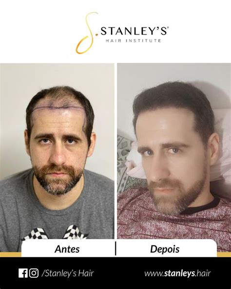 Two Men Are Shown Before And After Haircuts In This Graphic Above Is An