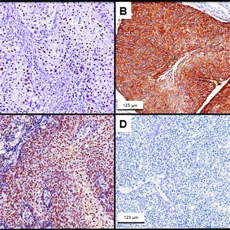 Radiosensitivity Profile Of Cervical Cancer Cell Lines A Cells Were