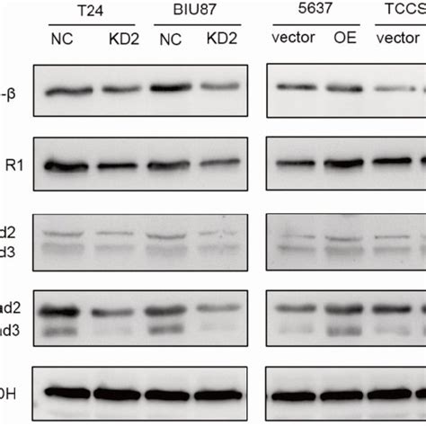 Adnp Activates Tgf Pathway In Bc Cells Bc Cells Were Treated With