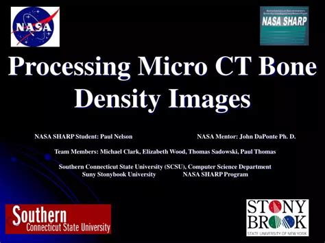 PPT - Processing Micro CT Bone Density Images PowerPoint Presentation ...