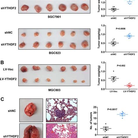 YTHDF2 Overexpression Attenuated Tumorigenicity And Metastasis Of