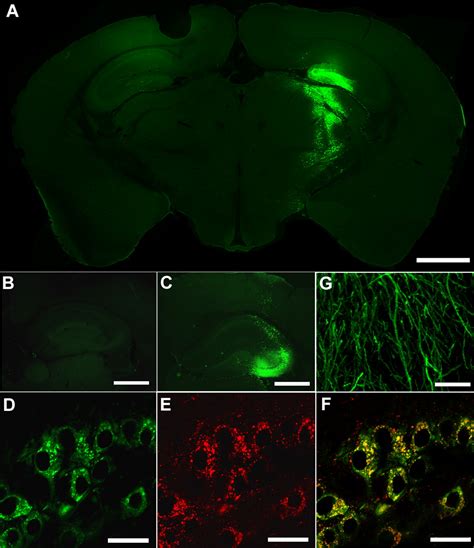 Intracranial Delivery Of Cln2 Reduces Brain Pathology In A Mouse Model